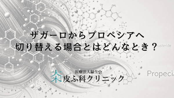 ザガーロからプロペシアへ切り替える場合とはどんなとき？副作用改善の可能性について