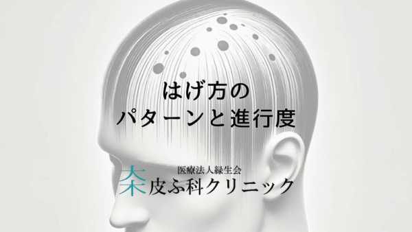 はげ方のパターンと進行度｜種類別の治療アプローチ