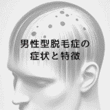 男性型脱毛症の症状と特徴｜原因から対策まで徹底解説