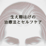 生え際はげの進行を止める治療法とセルフケア
