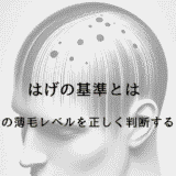 はげの基準とは - 自分の薄毛レベルを正しく判断する方法