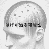 はげが治る可能性｜成功事例から見る効果的な治療法