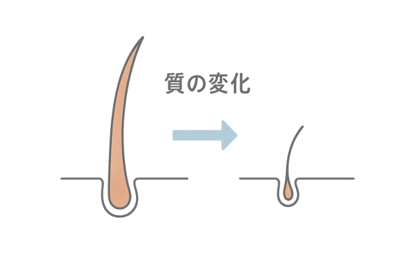 AGA初期症状 – 細く短い抜け毛の比較イラスト
