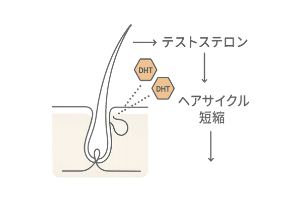 AGAとは?毛包とDHT作用の模式図
