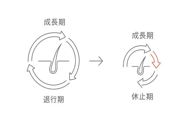 正常ヘアサイクル vs 乱れたヘアサイクル