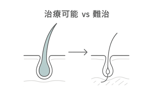 活動毛根とミニチュア化毛根の比較