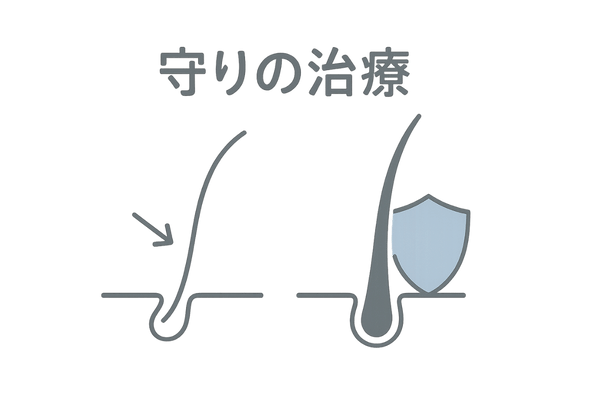 抜け毛進行をブロックする守りの治療イメージ