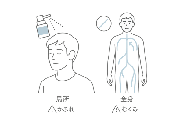 ミノキシジル外用 vs. 内服タブレット – 効果と副作用の違い