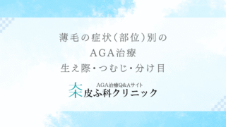 薄毛の症状（部位）別のAGA治療 – 生え際・つむじ・分け目