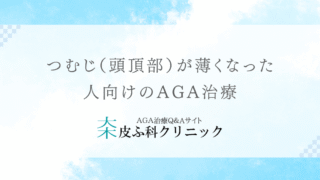つむじ（頭頂部）が薄くなった人向けのAGA治療