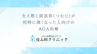 生え際と頭頂部（つむじ）が同時に薄くなった人向けのAGA治療