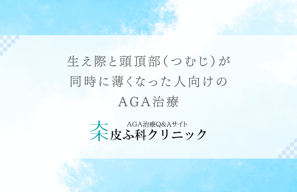 生え際と頭頂部（つむじ）が同時に薄くなった人向けのAGA治療