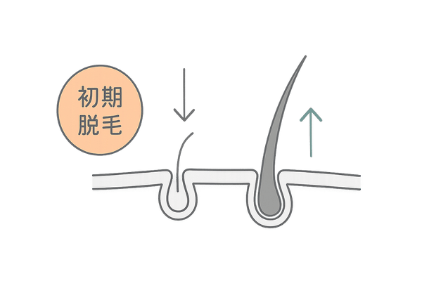 初期脱毛と健康な髪への置き換わりプロセス図