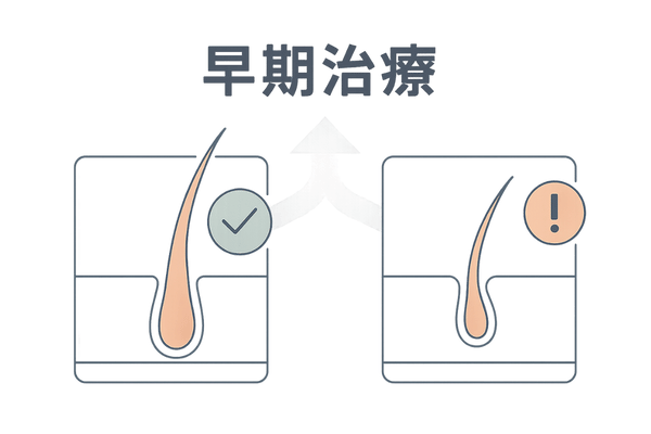 早期治療で救える毛根イラスト