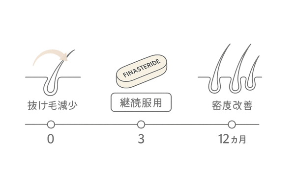 フィナステリド効果発現タイムラインイラスト