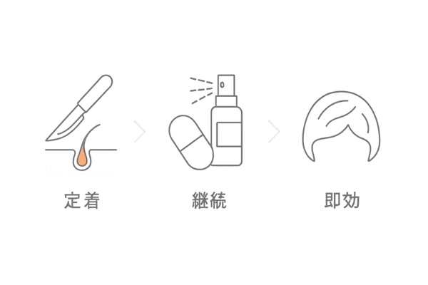 自毛植毛と他の薄毛治療法を比較するインフォグラフィック