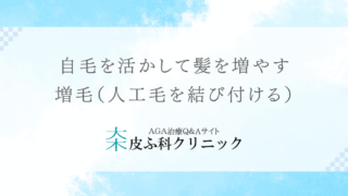 自毛を活かして髪を増やす – 増毛（人工毛を結び付ける）