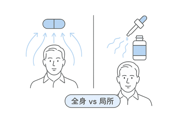内服と外用ミノキシジル効果範囲比較イラスト