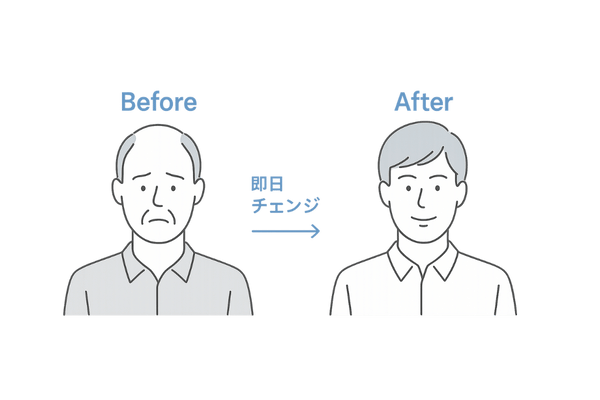 ウィッグで即日フルカバー