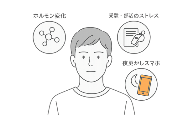 10代男子に多い薄毛トリガーのイメージ(ホルモン・ストレス・生活習慣)