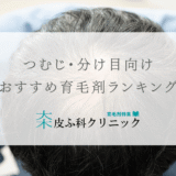 つむじや分け目の薄毛対策向けにおすすめの育毛剤