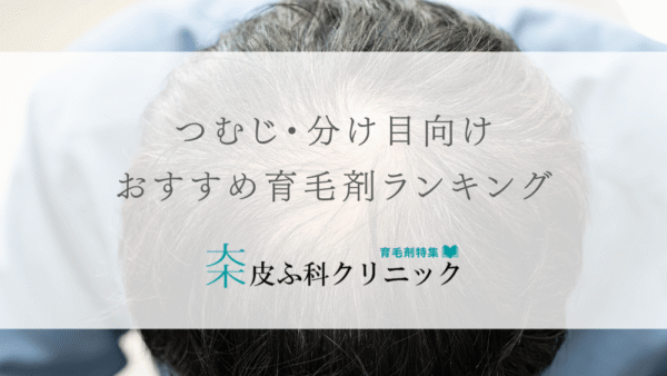 つむじや分け目の薄毛対策向けにおすすめの育毛剤（2025年版ランキングあり）