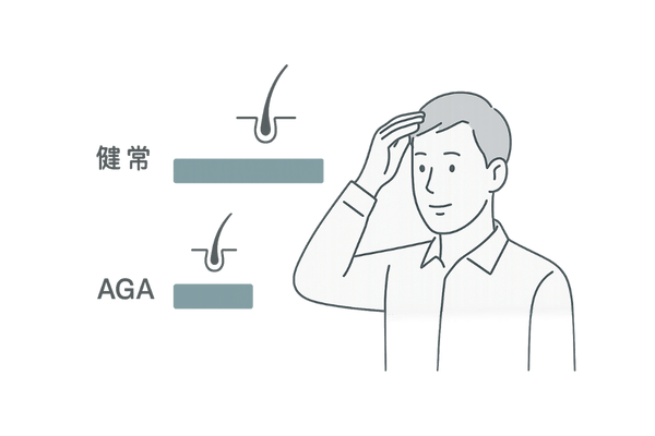 ヘアサイクル比較（健常 vs AGA：成長期短縮のイメージ）