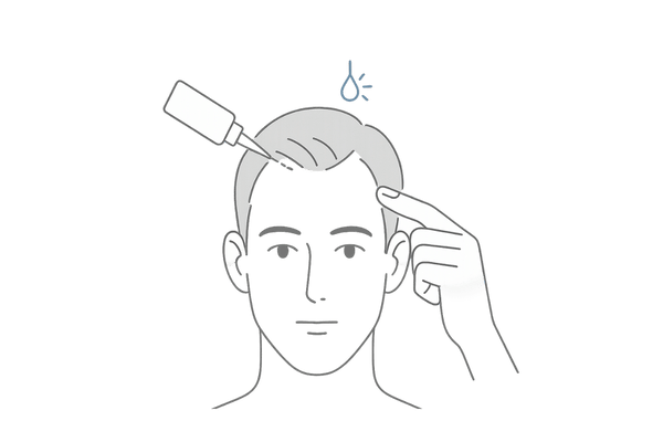 生え際・M字のキワまで届く塗布イメージ(男性向け育毛剤)