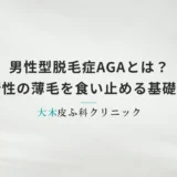 男性型脱毛症AGAとは？進行性の薄毛を食い止めるための基礎知識