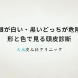 抜け毛の毛根が白い・黒いどっちが危険？形と色で見る頭皮診断