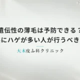 遺伝性の薄毛は予防できる？家系にハゲが多い人が行うべき発症遅延ケア