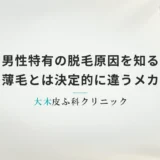男性特有の脱毛原因を知る｜女性の薄毛とは決定的に違うメカニズム