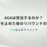 AGAは完治するのか？治療を止めた後のリバウンドと維持の真実