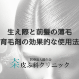 女性の生え際と前髪の薄毛改善法 – 育毛剤の効果的な使用法