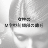 女性のM字型前頭部の薄毛 – 髪型による対処法