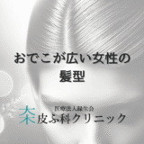おでこが広い女性の髪型｜薄毛をカバーするテクニックと治療