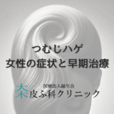 つむじハゲに悩む女性の症状と早期治療の重要性