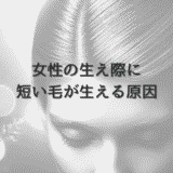 女性の生え際に短い毛が生える原因と専門医による治療法