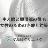生え際と頭頂部の薄毛｜女性のための治療と対策