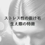 ストレス性の抜け毛｜女性の生え際における特徴