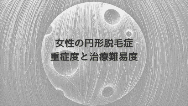 女性の円形脱毛症における重症度と治療難易度