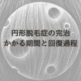 女性の円形脱毛症の完治にかかる期間と回復過程