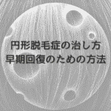 女性の円形脱毛症の治し方｜早期回復のための方法