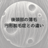 後頭部の薄毛に悩む女性の症状と治療｜円形脱毛症との違い