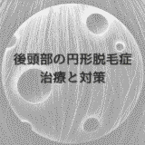 後頭部の円形脱毛症に悩む女性の治療と対策