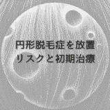 女性の円形脱毛症を放置するリスクと初期治療