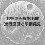 女性の円形脱毛症の進行速度と早期発見のポイント