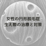 女性の円形脱毛症で生え際が薄くなったときの治療と対策