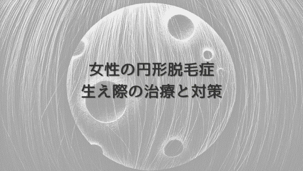 女性の円形脱毛症で生え際が薄くなったときの治療と対策