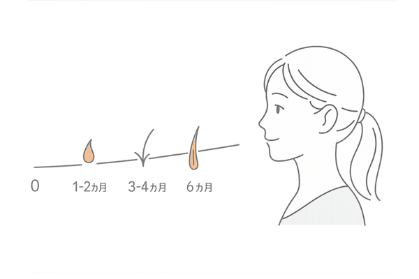 ミノキシジル1%の効果タイムライン|初期脱毛~6か月